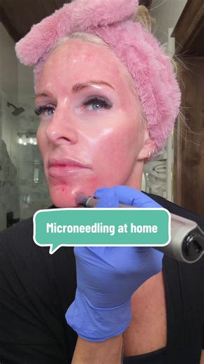 Microneedling at Home with DR PEN: A Guide