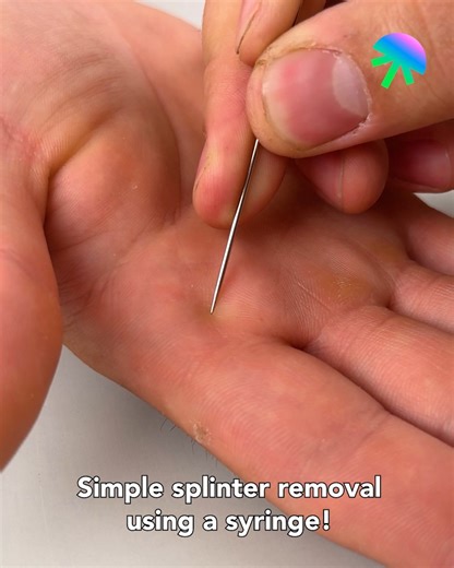 211K views · 723 reactions | Simple splinter removal using a syringe! | Genius Craft | Facebook