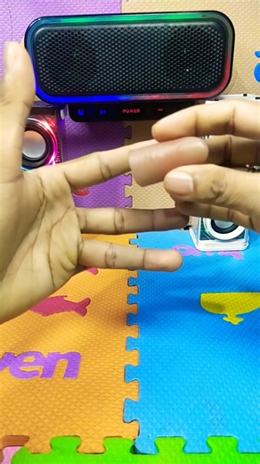 his finger fell off #shorts