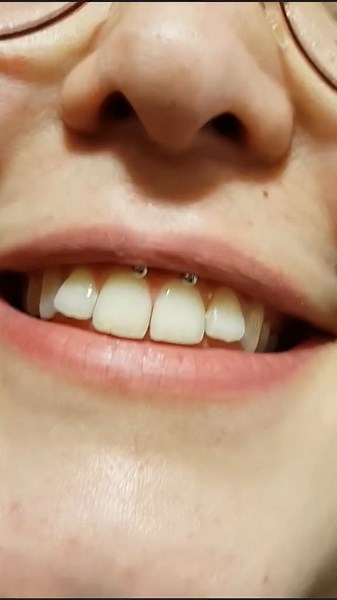 Unique Smiley Piercing Video - A Comprehensive Guide