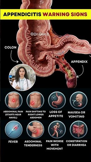 Appendicitis Red Flags You Should Never Ignore