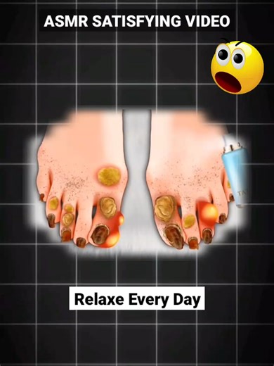 Relax Every Day With Sac Dep Spa | 24 | #acne #blackheads #whiteheads #Treatments #pimple #SacDepSpa #asmr #spa #relievestress #relax #massage #skincare #fypシ #shortvideo #shortsfeed #shortsvideo #shorts #short #foryou #trending #forforyoupage #ownvoice #viral #fyp #reelsfypシ #grow