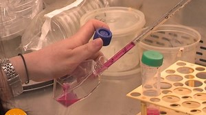 활성산소 잡는 ‘세리아 나노 입자’ 개발