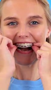 70K views · 687 reactions | Gadgets vs hacks || useful hacks and gadgets for every occasion: | FoodGasmic | Facebook