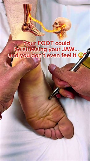 Your FOOT could be stressing your JAW… and you don’t even feel it 😳” What you see here is not random. There’s a deep fascial neurological connection between your feet and your jaw (TMJ). When your foot mechanics are off… When your plantar fascia is tight… When your arch collapses or your ankle is restricted… 👉 the tension travels up the kinetic chain 👉 into your calves 👉 into your hips 👉 into your spine 👉 all the way to your neck and jaw And suddenly you have: ⚠️ jaw tightness ⚠️ teeth gri