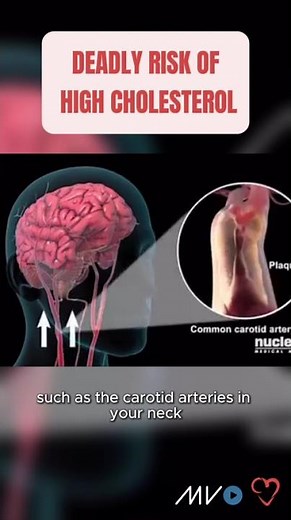 Today is Familial Hypercholesterolemia (FH) Awareness Day 🧬🫀