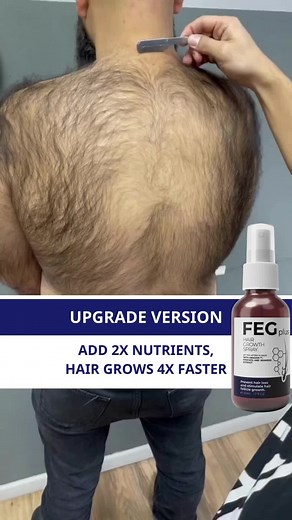 FEG Plus Hair Serum Official على TikTok