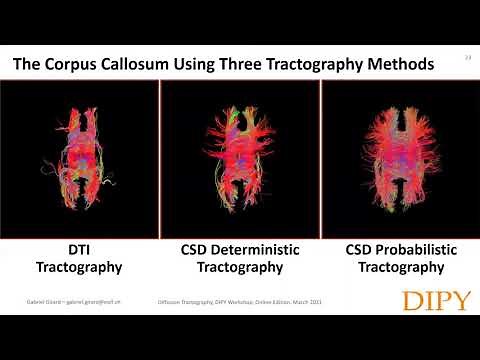 Diffusion Tractography Part 1 - Introduction to Tractography