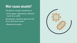 Cold season is here. Did you know that sinusitis is commonly caused by a viral upper respiratory infection, such as a cold? Watch these quick facts for symptoms and tips to feel better soon. Learn more: https://msdmnls.co/41E2RVM | MSD Manual Consumer