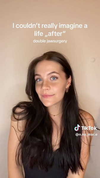 Double Jaw Surgery Recovery: Before, During, and After