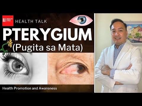 Pterygium (Pugita sa Mata): Causes, Symptoms, Complications, Treatment & Prevention