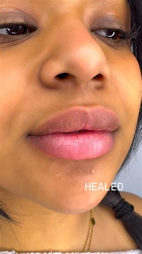 Touch up after 1 session dark lip neutralization. #ksa #lips #kuwait #darklips #permanentmakeup