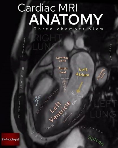 Cardiac MRI anatomy
