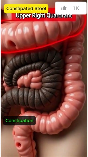 What Constipation Actually Looks Like Inside You 🛑 | Pro08