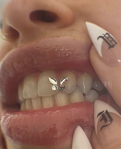 Tooth Gems: Stylish Accessories for Your Smile