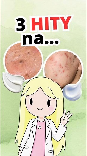 3 HITS for blackheads and oily skin!