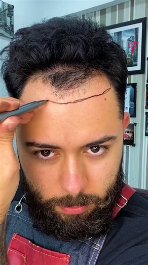21K views · 146 reactions | Hairpiece Magic: Man Moves Hairline Forward with Style! ‍♂️✨ Discover the Perfect Use of a Hairpiece for a Receding Hairline. Share Your Hair Transformation Stories! #HairpieceMagic #HairTransformation | Fabiosa Hearty | Facebook