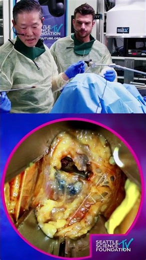 Watch a highlight from Dr Paul Park's OLIF Demonstration!