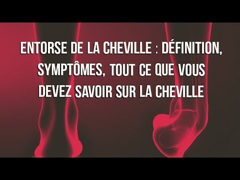 Entorse de la cheville : définition, symptômes, tout ce que vous devez savoir sur la cheville