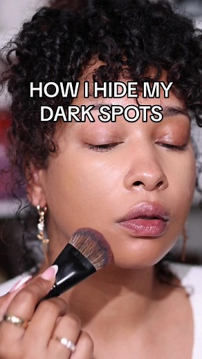 How to Cover Hyperpigmentation and Acne Scarring | Makeup Tutorial