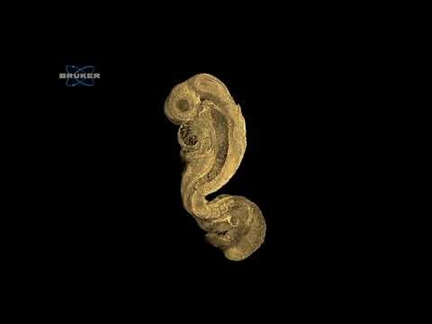 Rat embryo in its early stage of development