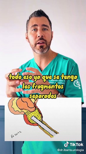 Cirugía de Próstata Innovadora: HoLEP y sus Beneficios