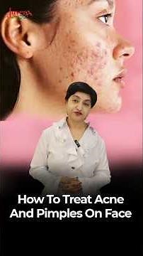 How To Treat Acne & Pimples On Face | Avoid These Mistakes | Excoriated Acne Explained!