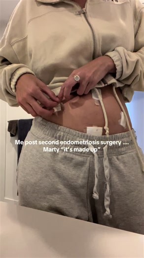 Endometriosis Awareness: My Pain Journey and Surgery