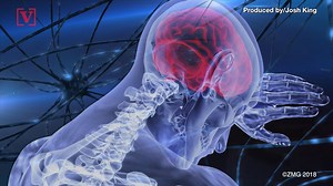 AI Is Helping to Decide Whether Coma Patients Will Wake Up - video Dailymotion