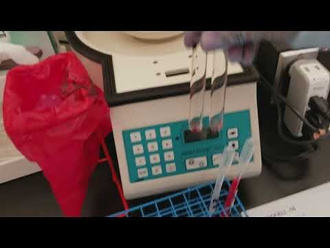 Blood Banking: Antibody Identification Panel Part 1