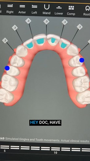 3K views | Doc, if you’ve ever looked at an aligner case and thought,...