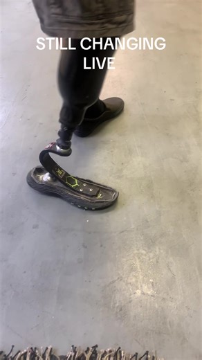 Changing Lives with Great prosthetic feet. Game Changer.