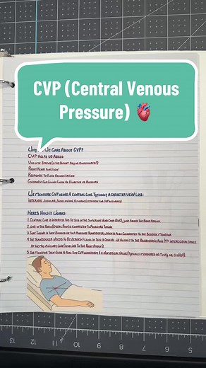 Understanding Central Venous Pressure (CVP) in ICU