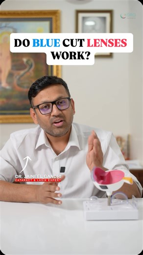 Dr. Jaineel Sanjay Gandhi on Instagram: "Do Blue Cut Lenses Really Protect Your Eyes? Facts, myths, and practical guidance for screen users. Dr. Jaineel Gandhi👨‍⚕️ M.S OPHTHALMOLOGY🎖️ Cataract, Lasik & Retina Surgeon SRG EYE HOSPITAL 🏥 📍P A/5, Shivalik Business Centre, Rajpath Rangoli Rd, Ahmedabad: 380054📇 📍C-1, Shivani Apart., b/h Sahajanand College Ambawadi, Ahmedabad : 380001📇 Book your consultation☎️ +91 9408500060 #srgeyehospital #drjaineelgandhi #bluecutlens #mythvsfact #explore"