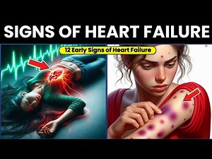 12 Early Signs of Heart Failure You Shouldn’t Ignore!