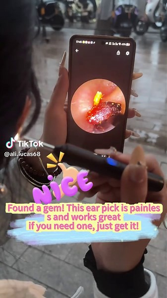 Traditional ear picking is like a blind box? The visual ear pick shows even ear canal hair clearly! 15MP HD lens soft silicone tip, safe for the elderly and kids. Goodbye to blind picking risks. #earwaximpaction #grandma #earwax #earwaxremoval #gross
