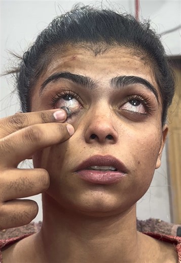 Lenses Application | lenses