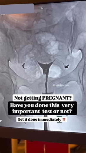 Dr Aashita Jain| Fertility Doctor | Gynaecologist | “Trying to conceive but not getting the two pink lines? 💔” One of the most overlooked tests when couples struggle to conceive is the HSG... | Instagram