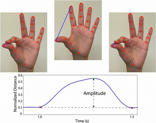 AI detects subtle movement changes in finger-tapping videos, revealing hidden Parkinson's signs