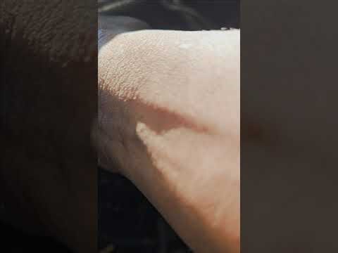 Ford Transit Injector Removal – £420 Job on a 2017 Model