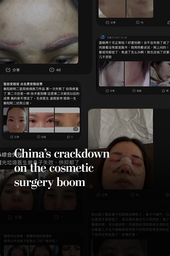 China’s crackdown on the cosmetic surgery boom