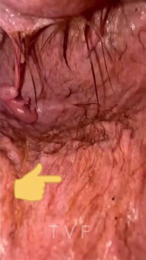 Kangaroo Baby Is Born THIS Small! 🦘😱 #facts #youtubeshorts