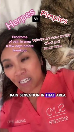 Herpes vs Pimples