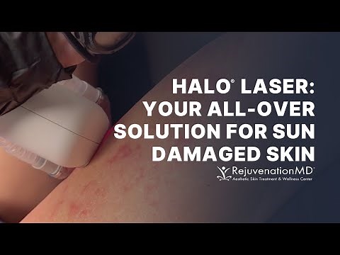 Halo Laser: Effective Treatment for Actinic Keratosis