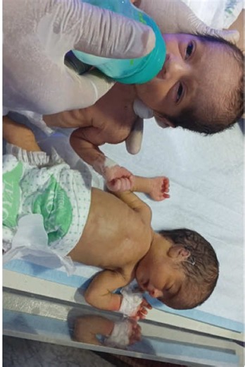 Newborn Twins (Preterm & Low Birth Weight) First Trial Bottle Feeding Protocol #NeonatalCare #PretermBaby #LowBirthWeight #LBW #Twins