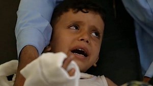 الحرب الأهلية في اليمن: تحقيق لبي بي سي يوثق حالات من الضحايا الأبرياء للحرب الأهلية - BBC News عربي
