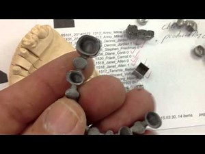 Laser metal sintering