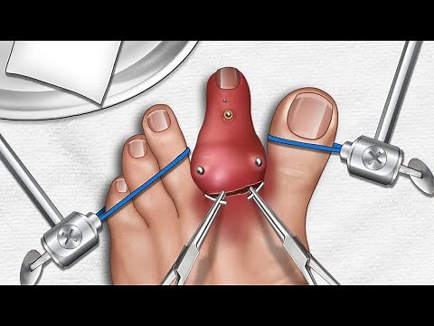 [ASMR Animation] WOW Brain Satisfying video