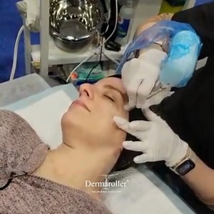 We've got your back, and your skin!  Safety is paramount with TWIST - using only medical-grade, sterile tips for each treatment. Your trust means everything to us.  | Dermaroller | Facebook