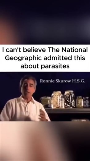 16K views · 146 reactions | This world is riddled with parasites and...